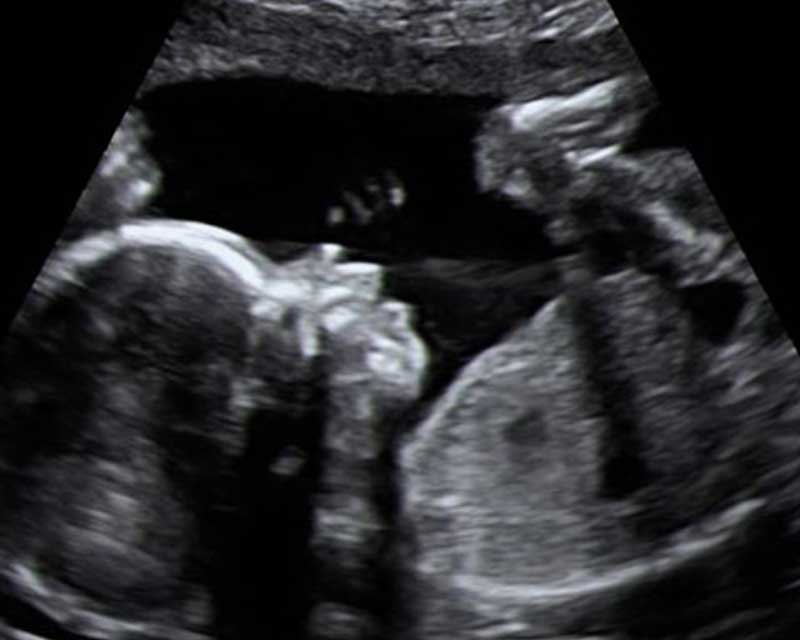 2d ultrasound scan cheras