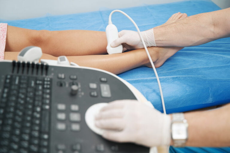 Doppler ultrasound machine in Klinik Azurose