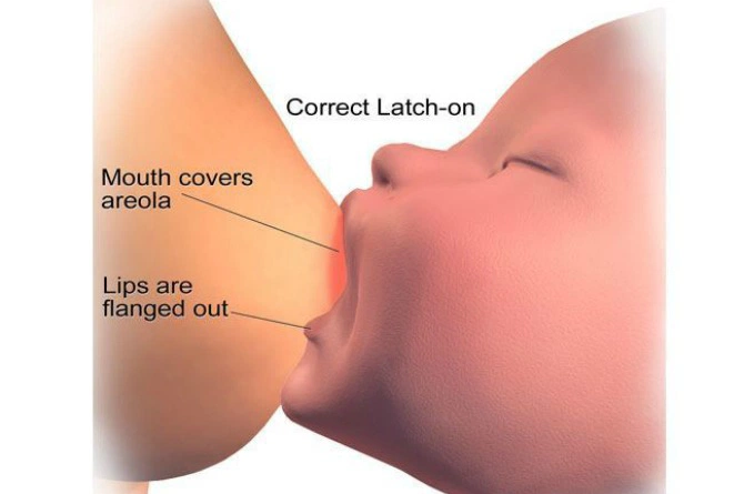 correct latch on blood0in breastmilk