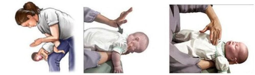 steps for emergency when your baby chokes on milk