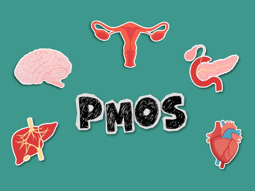 PMOS FI