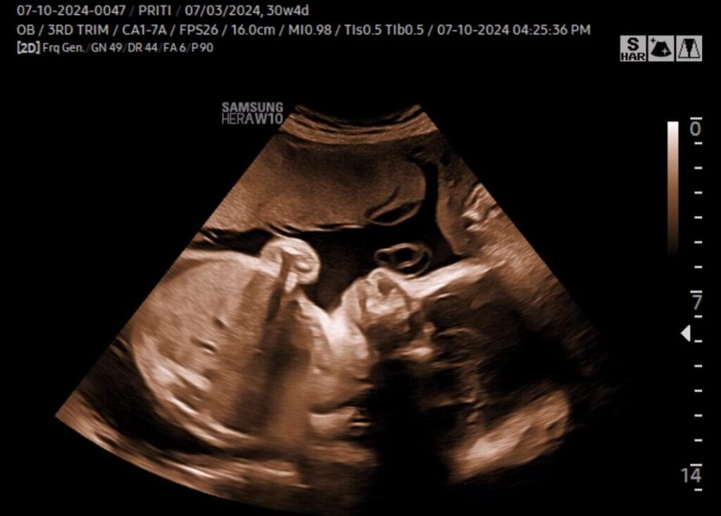 Trimester Ketiga: Persediaan Bersalin & Tanda Ibu Perlu ke Hospital 2 Third trimester